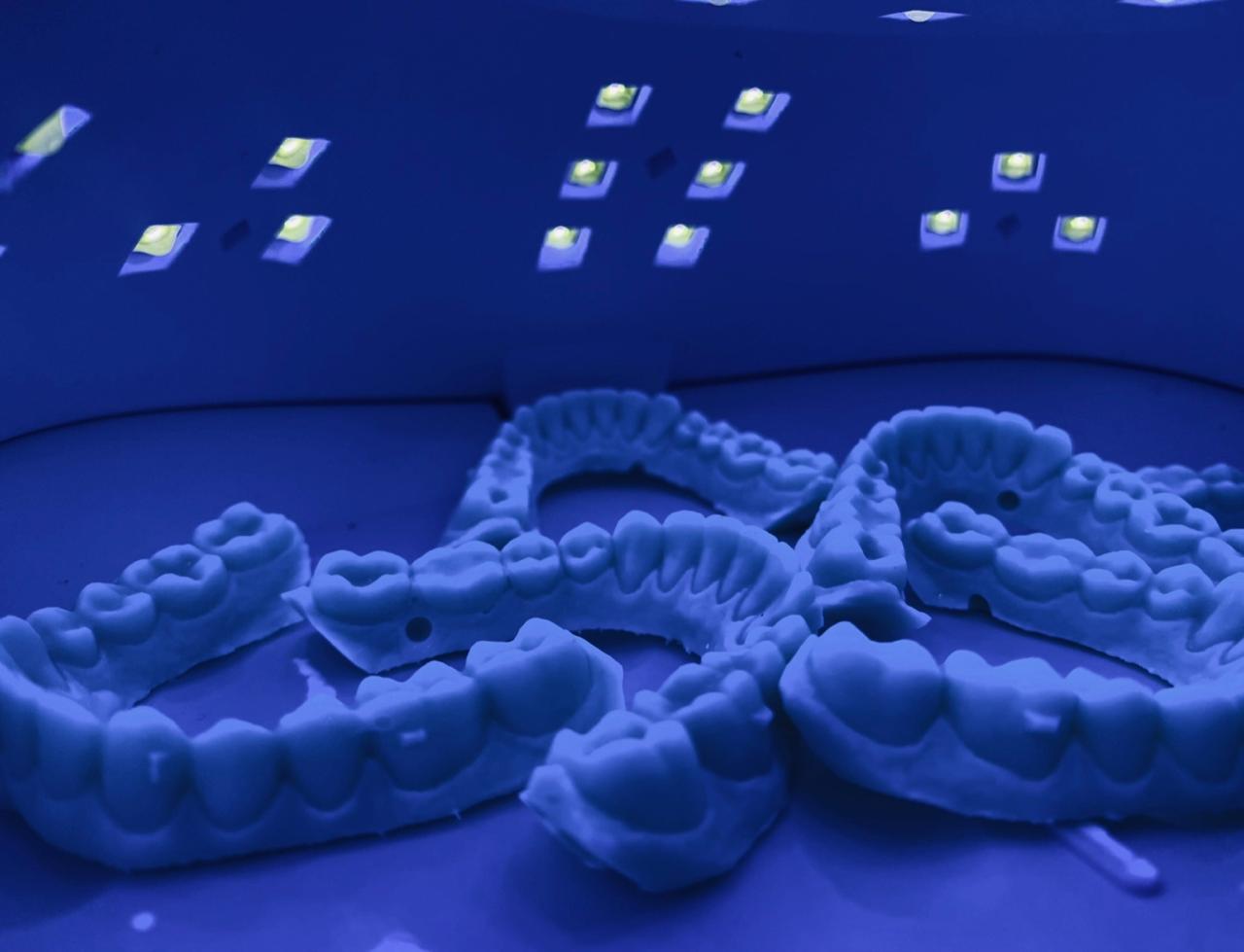 Laboratório Digital particular da OP — moldes odontológicos impressos em 3D sob luz UV, em Natal/RN